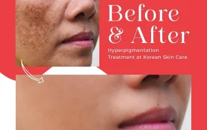 Best Korean Beauty Products in Nepal